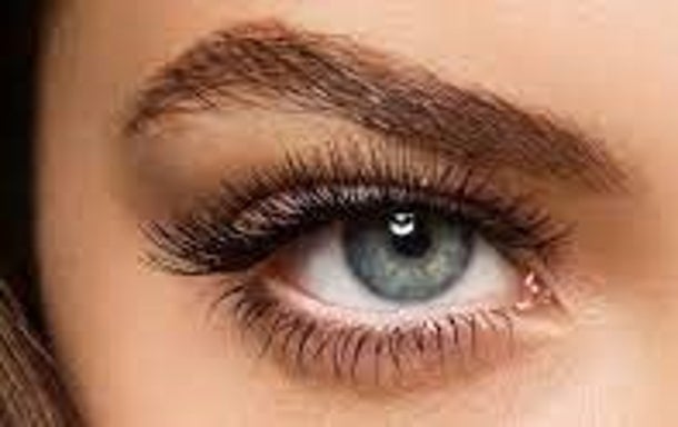 Brow lift