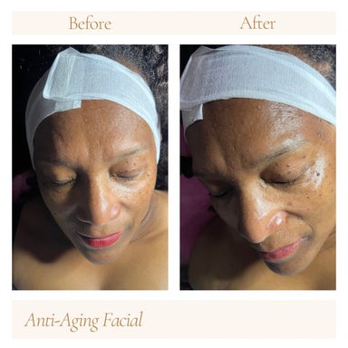 Anti-Aging Facial