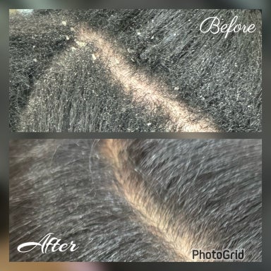 PRE Scalp Treatment (add on service only)