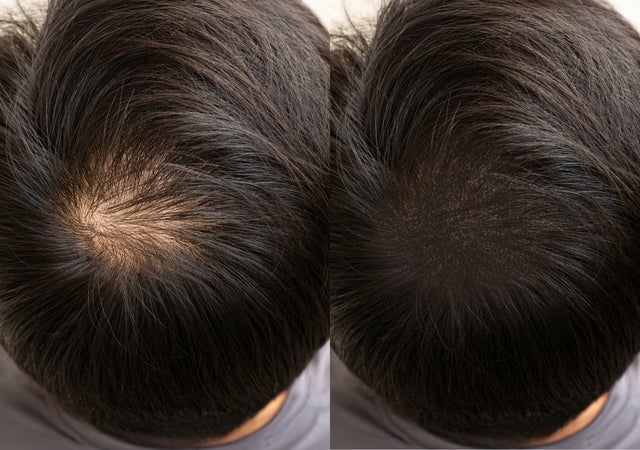 KOREAN SCALP SHADING - 50% OFF UNTIL AUG 31