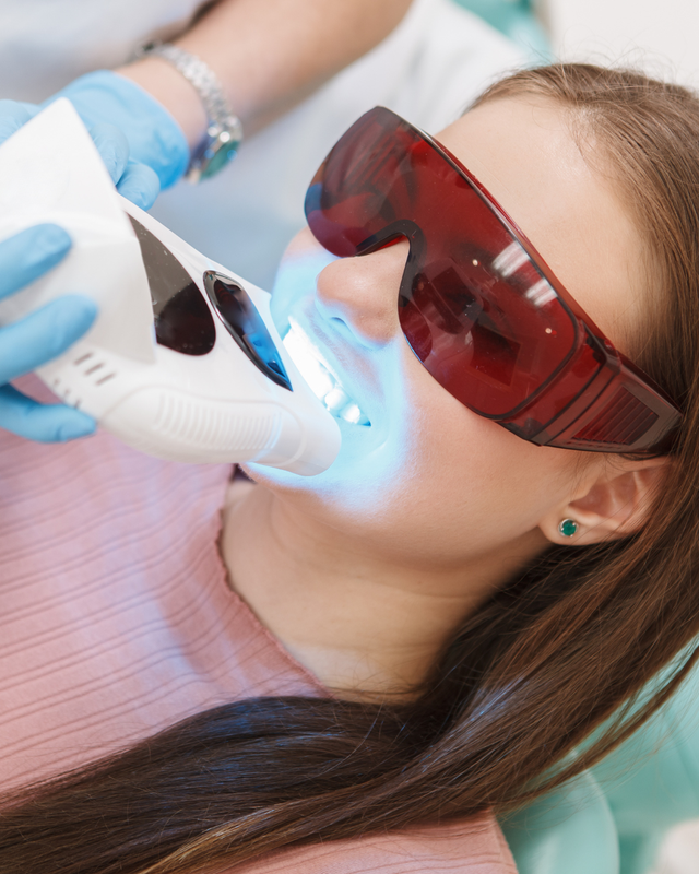 Teeth Whitening