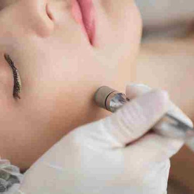 Diamond Glow Microdermabrasion Facial