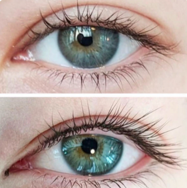 Precision Lashline Enhancement