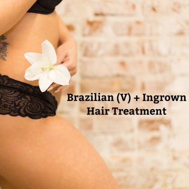 Brazilian (V) & Ingrown Hair Treatment