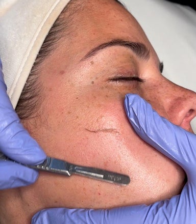 Smooth Operator Dermaplaning Facial