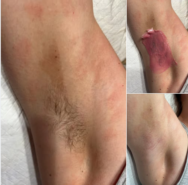 Body Waxing
