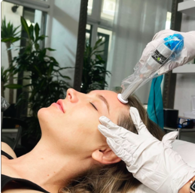 Pro-Cell Microchanneling Session