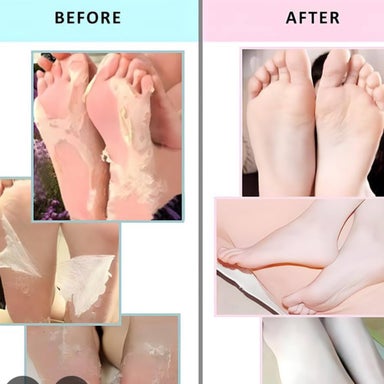 Hand or Foot Peels 45 min