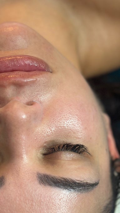 Waxing • Cheeks