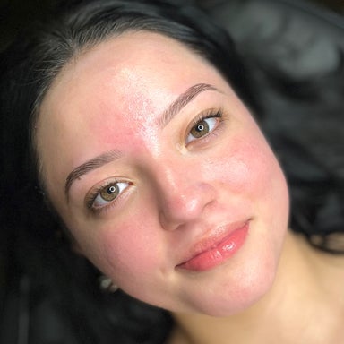 YourSkin60