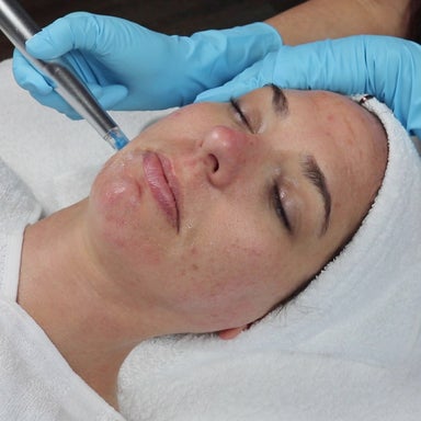 Rezenerate Nano Infusion Facial