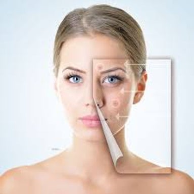 Hard-reset Microneedling Facial
