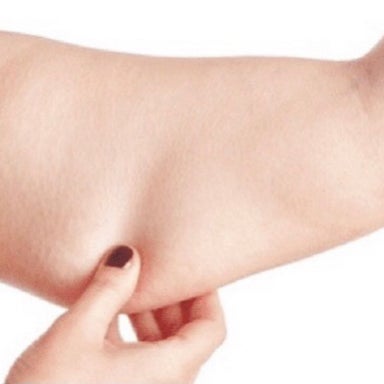 Arms Cellulite Reduction