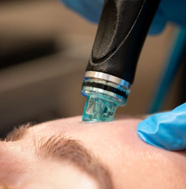 HYDRAFACIAL