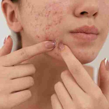ANB Teen Facial