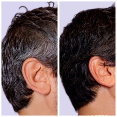 Gray Coverage