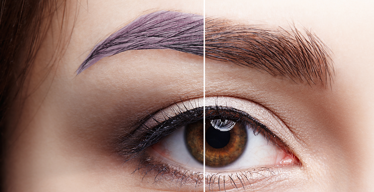Pigment Correction