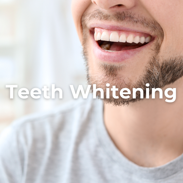 Teeth Whitening