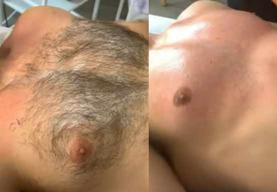 Chest and Stomach Wax