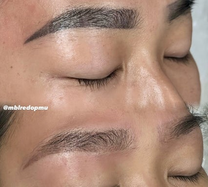 Laser Brow Tattoo Removal/Brow Toning