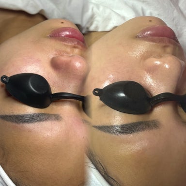 Korean Glass Skin Facials