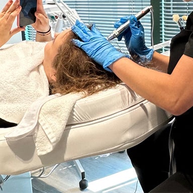 Scalp Microneedling (nano infusion + red light therapy