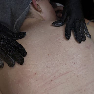 Facial for Back - Backacial