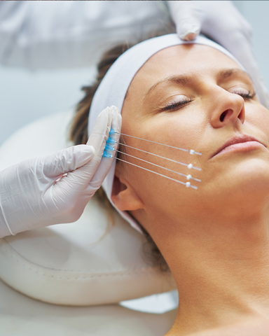 PDO Collagen Threads