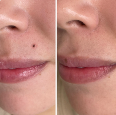 Supernatural Beauty Mark