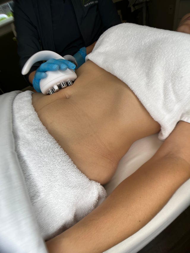 Skin Tightening