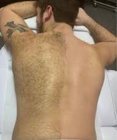Back Shave