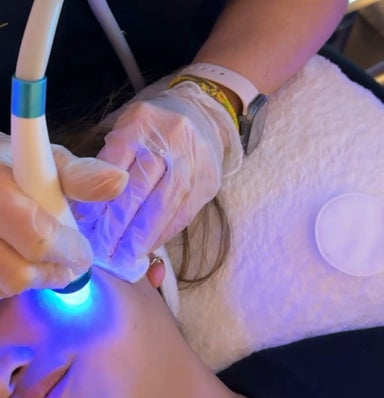 HydraFacial