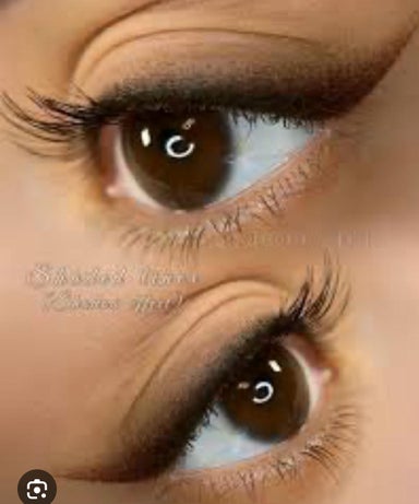 Eye liner (per side)