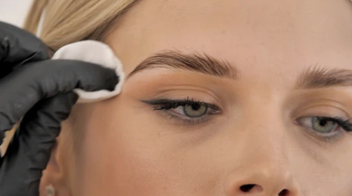 Brow Tattoo Removal