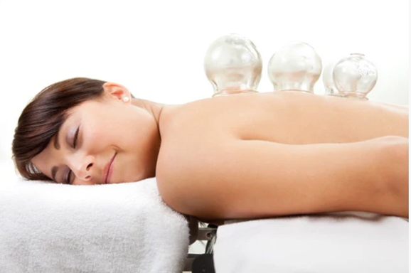 Cupping Therapy – Restore Circulation and Release Tension