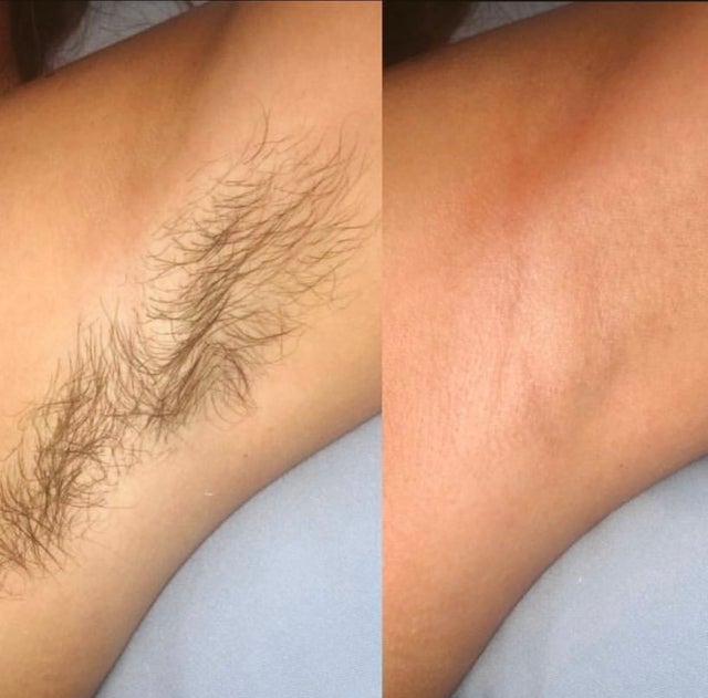 WAXING