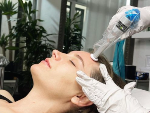 ProCell Microchanneling - Package of 4 Treatments