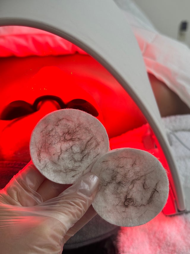 RESULTS BASED FACIALS