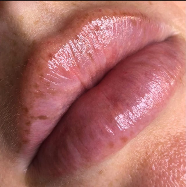 Lips