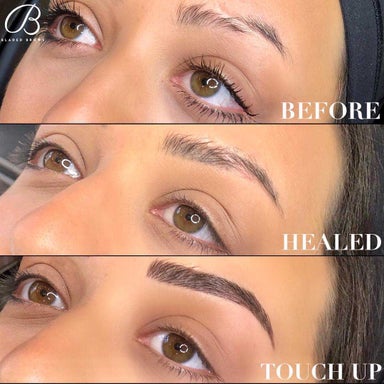 Touchup