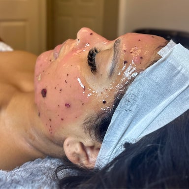 Hydra Facial