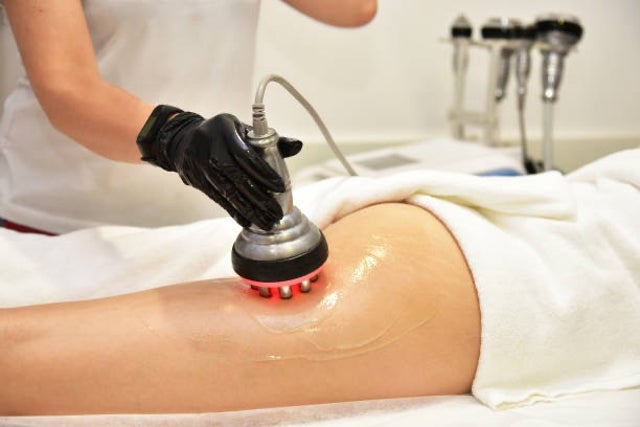 CAVITATION LIPO SKIN TIGHTENING AND FAT REDUCTION